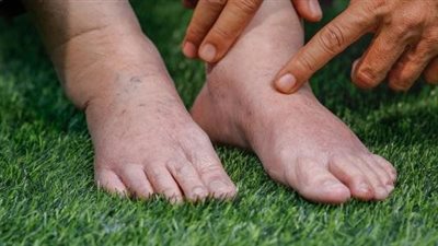 نصائح لتقليل تناول الأملاح