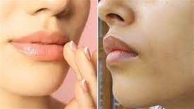 تخلصي من السواد حول الفم بطرق طبيعية وطبية