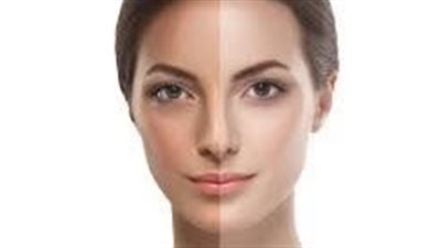 أسباب متعددة لاسمرار الجسم