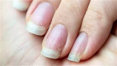 وداعاً للأظافر الضعيفة: 5 نصائح للحفاظ على أظافركِ قوية وصحية