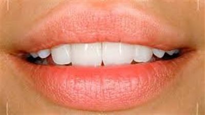  نصائح قبل تركيب ابتسامة هوليود المتحركة