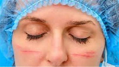 الخطوات الرئيسية لعلاج چروح الوجه