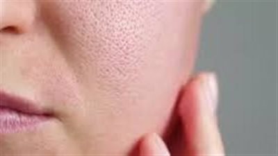 كيف أتخلص من مسامات الوجه