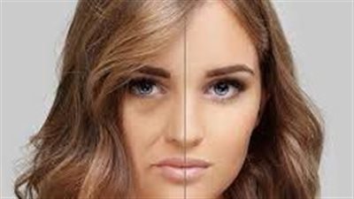ما هي حقن الدهون في الوجه؟