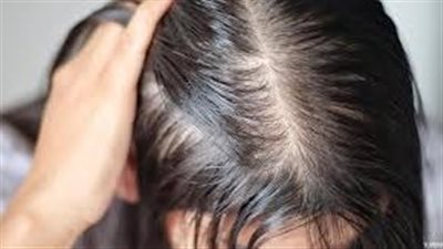 نصائح عملية لزيادة كثافة الشعر وحمايته من التساقط