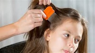 وداعاً للصيبان: إليكِ أسرع طريقة للتخلص منها