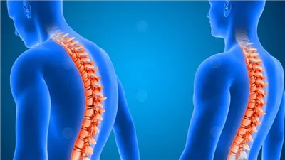 سلوكيات يومية تتسبب في انحناء العمود الفقري